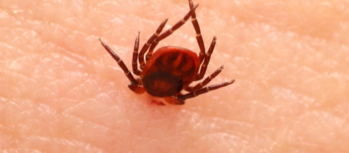 Encephalitis tick  Ticks on human skin. Ixodes ricinus can transmit both bacterial and viral pathogens such as the causative agents of Lyme disease and tick-borne encephalitis.