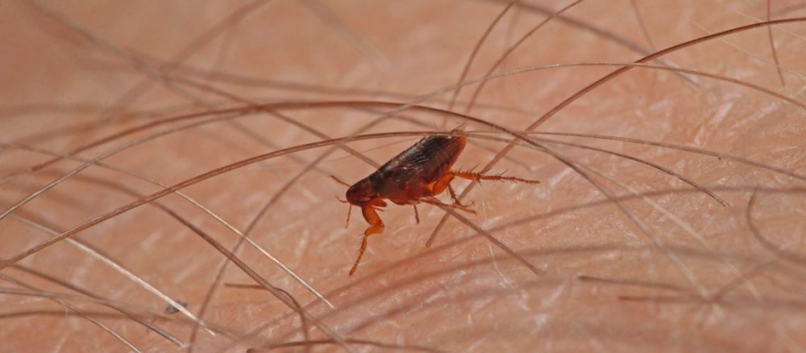 Flea,Walking,On,A,Human,Skin.,A,Tiny,Parasite,Sucking